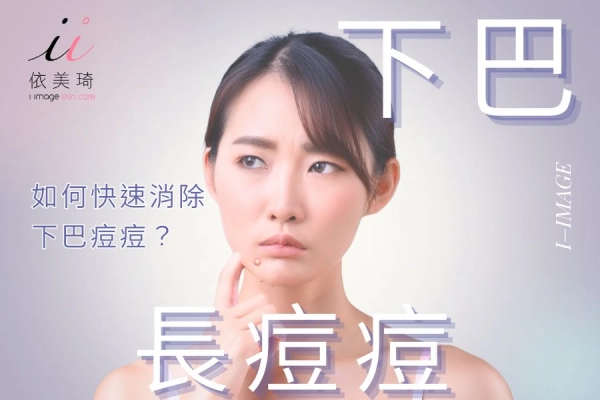 下巴長痘痘