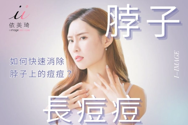 脖子長痘痘原因,如何消除痘痘