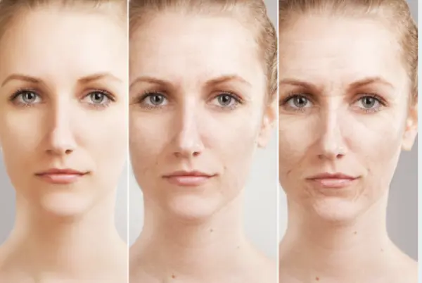 皮膚老化怎麼辦