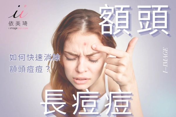 額頭長痘痘