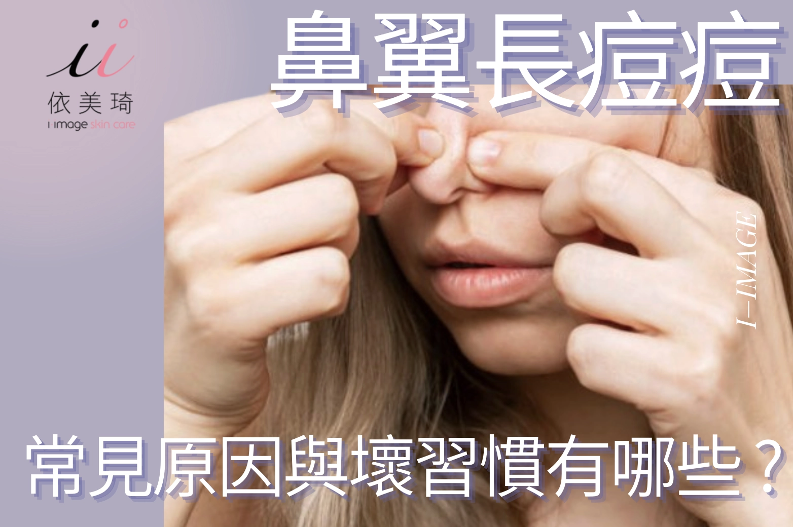 鼻翼一直長痘痘？不只是出油！常見原因與壞習慣有哪些？