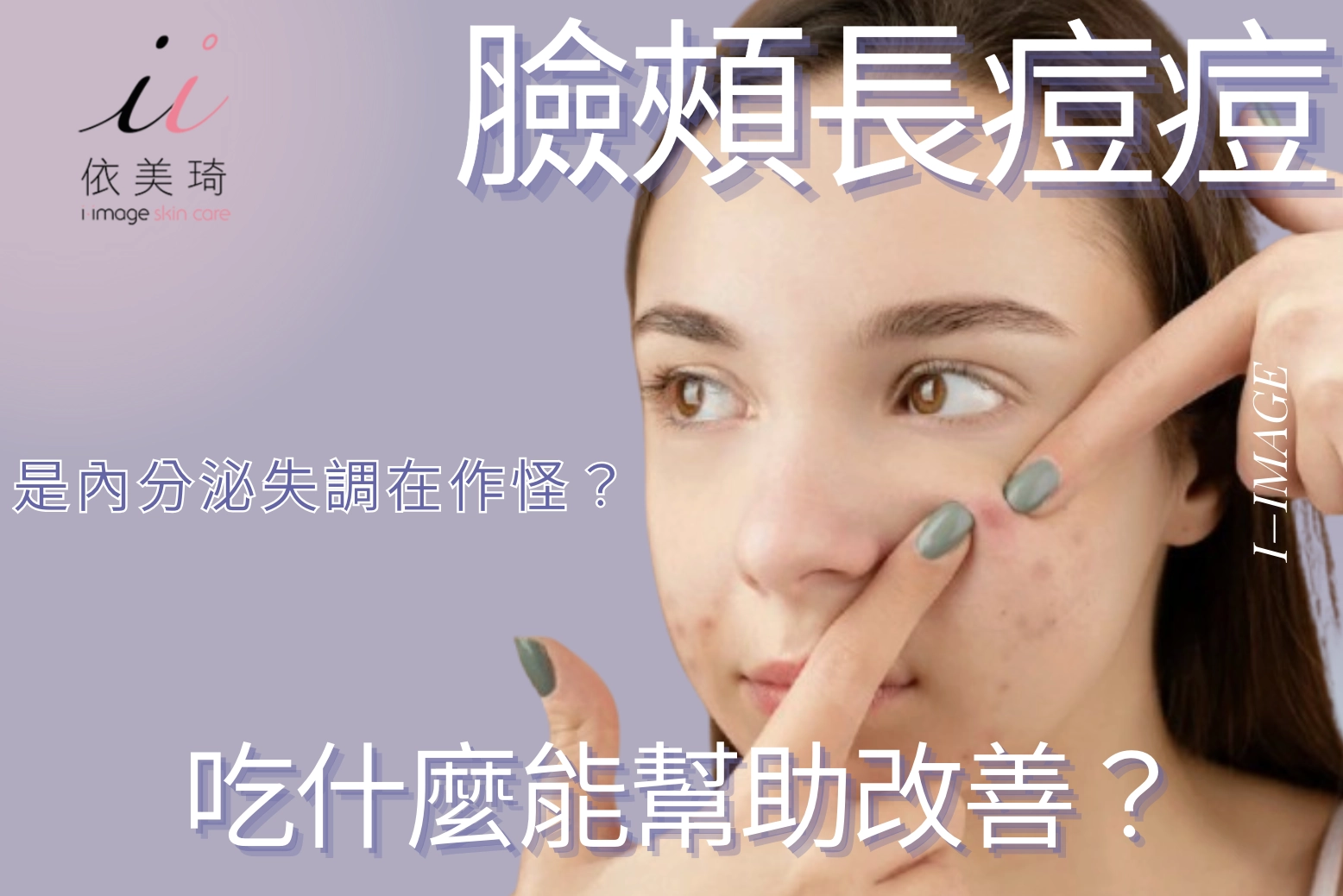 臉頰長痘痘是內分泌失調在作怪？吃什麼能幫助改善？