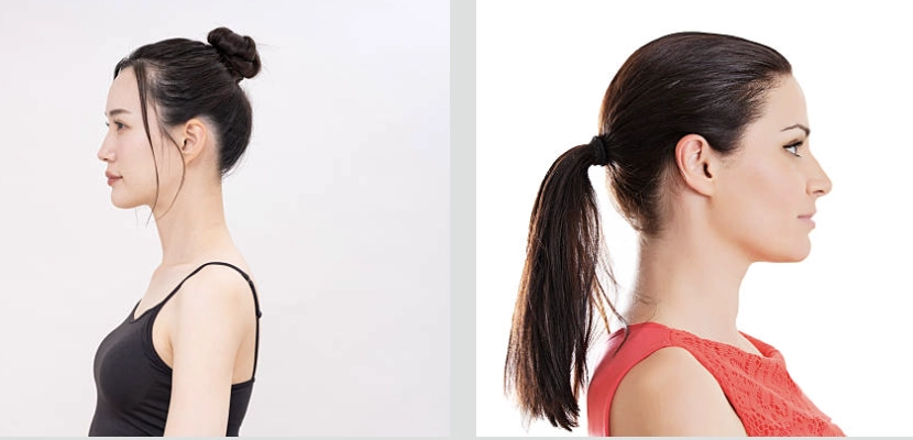 綁馬尾或盤頭髮後頸較不悶熱，可減少後頸長痘痘的發生率