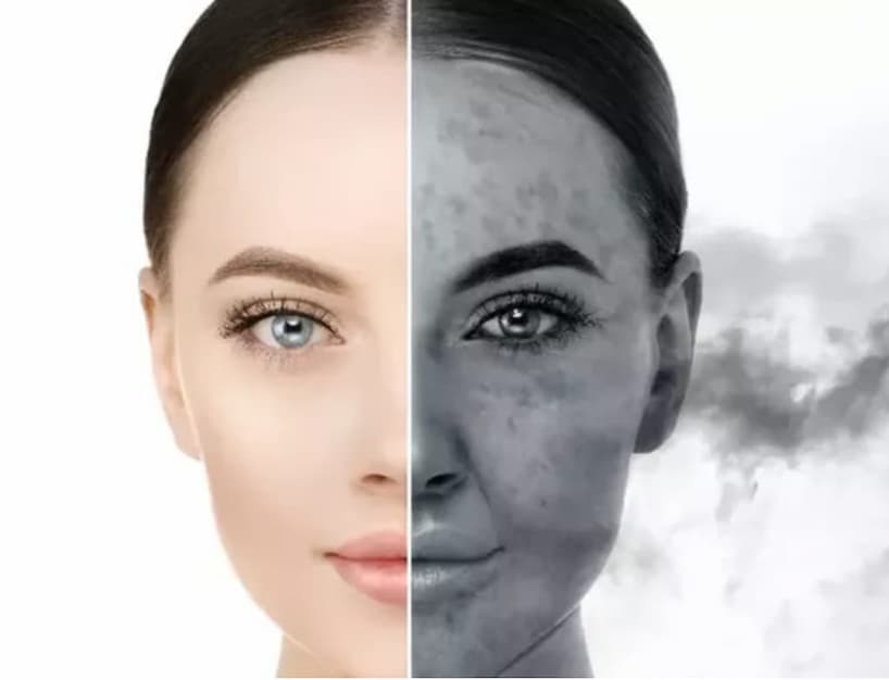 空氣污染造成皮膚發炎老化,堵塞毛孔要加強防曬,清潔與保濕