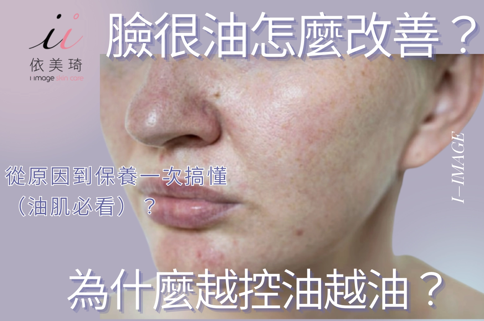臉很油怎麼改善？為什麼越控油越油？從原因到保養一次搞懂（油肌必看）